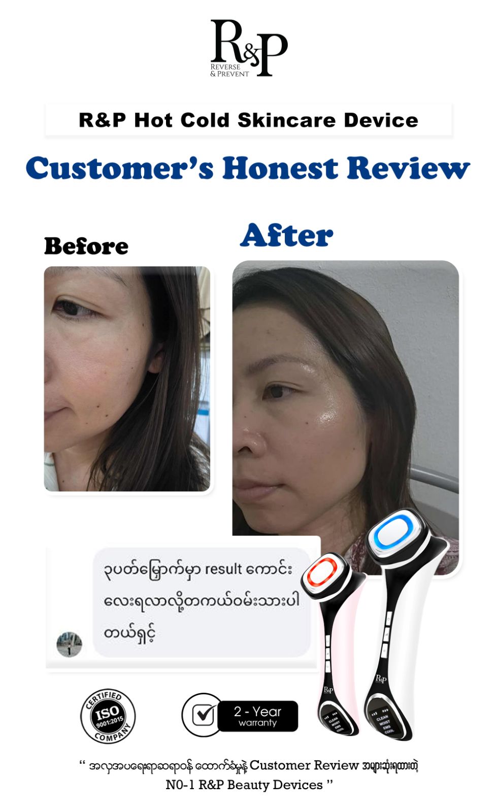 Review WMHF