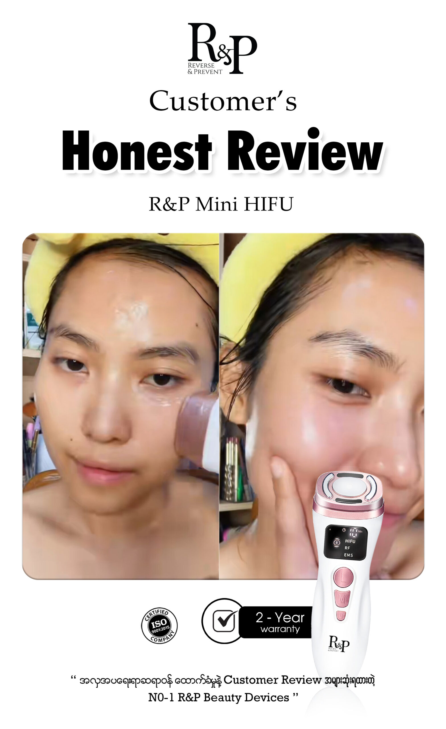 Review Mhf